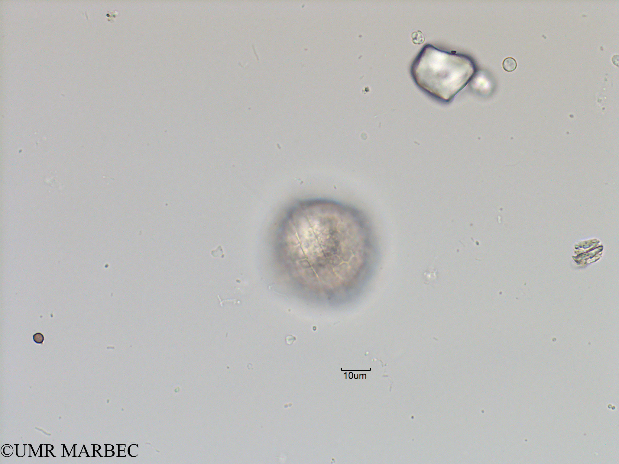 phyto/Bizerte/bizerte_bay/RISCO November 2015/Protoceratium spinulosum (Baie_T5-ACW1-Protoceratium reticulatum).tif(copy).jpg